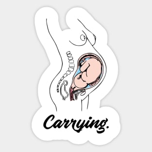 Carrying Pregnant Woman Anatomy - Medical Student in Medschool Sticker